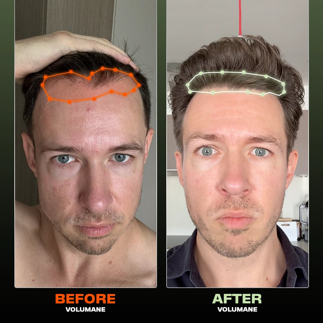 Volumane Hair Density + Regrowth Shampoo